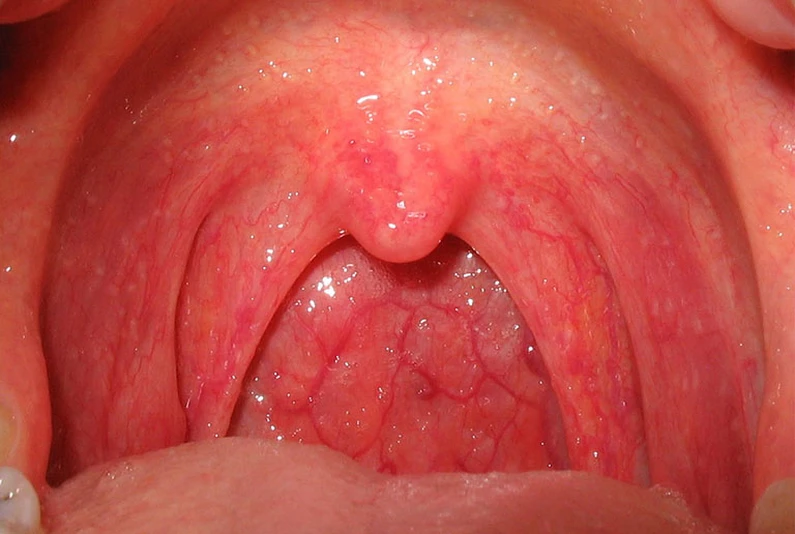 Thế Giới Implant