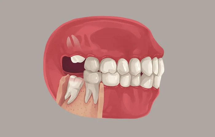 Thế Giới Implant