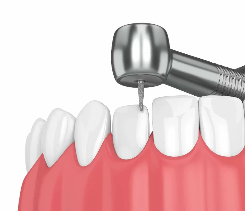 Thế Giới Implant