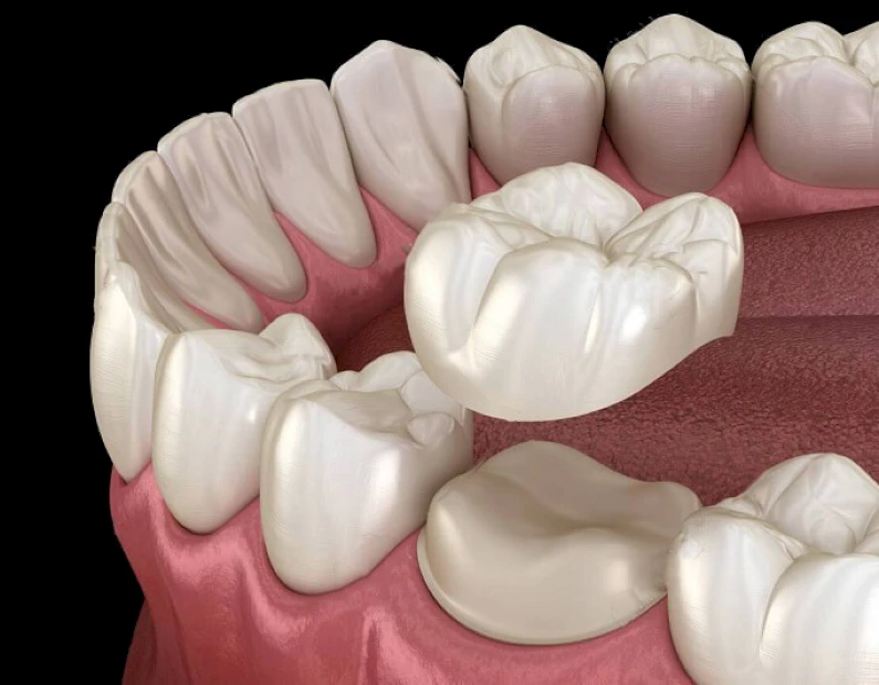 Thế Giới Implant