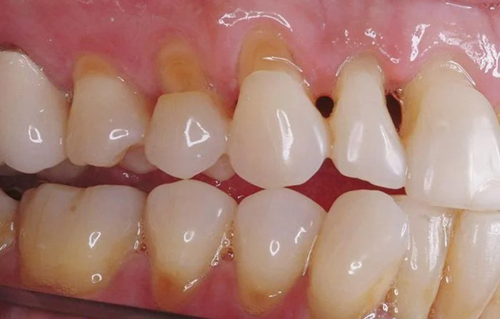 Thế Giới Implant