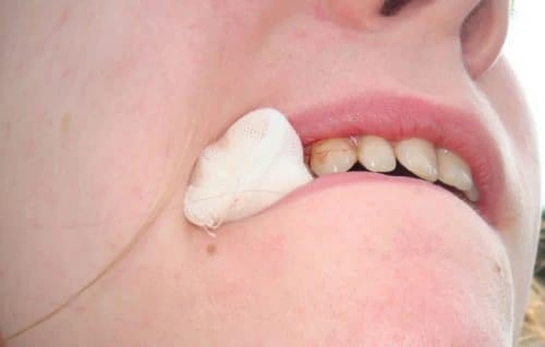 Thế Giới Implant