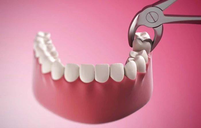 Thế Giới Implant