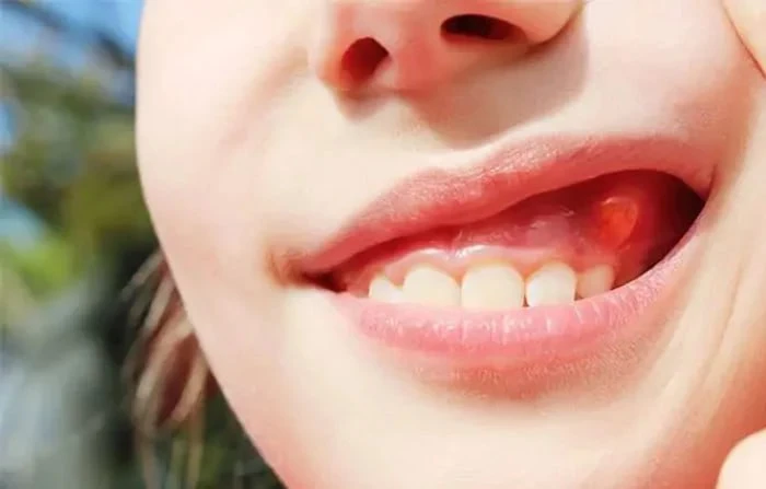 Thế Giới Implant