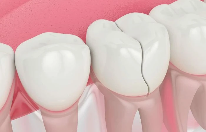 Thế Giới Implant