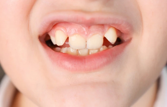 Thế Giới Implant