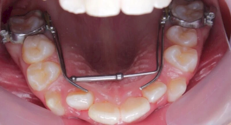 Thế Giới Implant