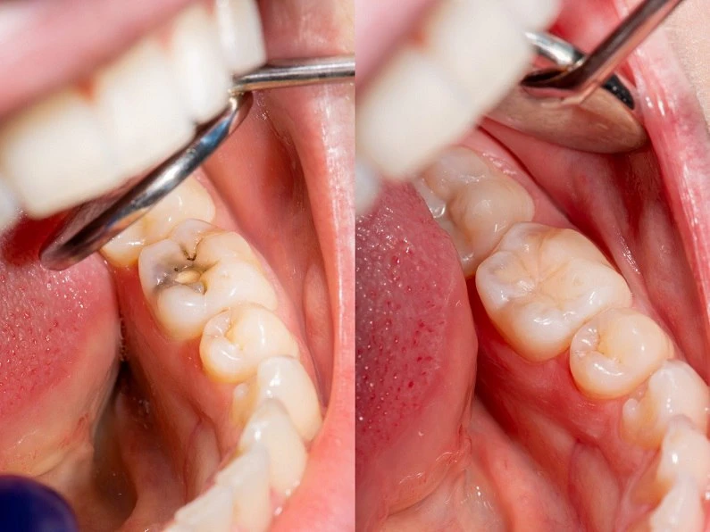 Thế Giới Implant