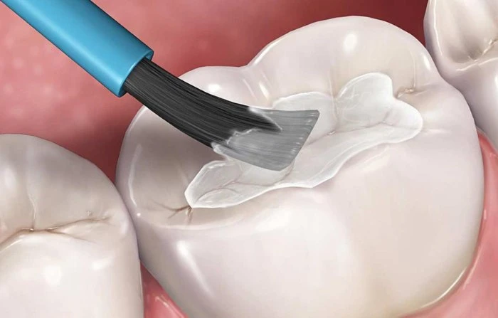 Thế Giới Implant