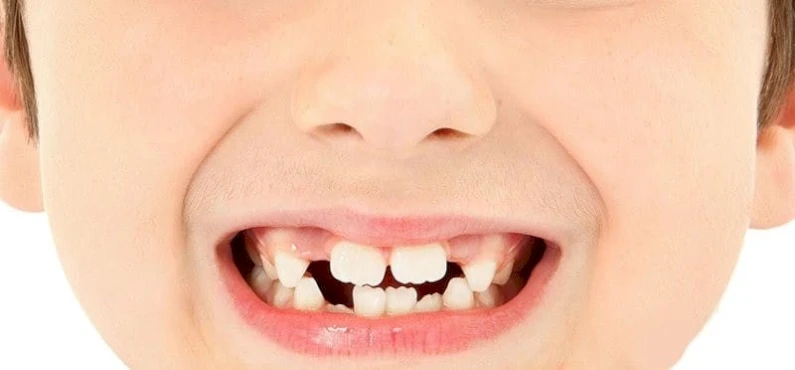 Thế Giới Implant