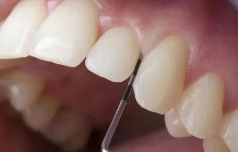 Thế Giới Implant