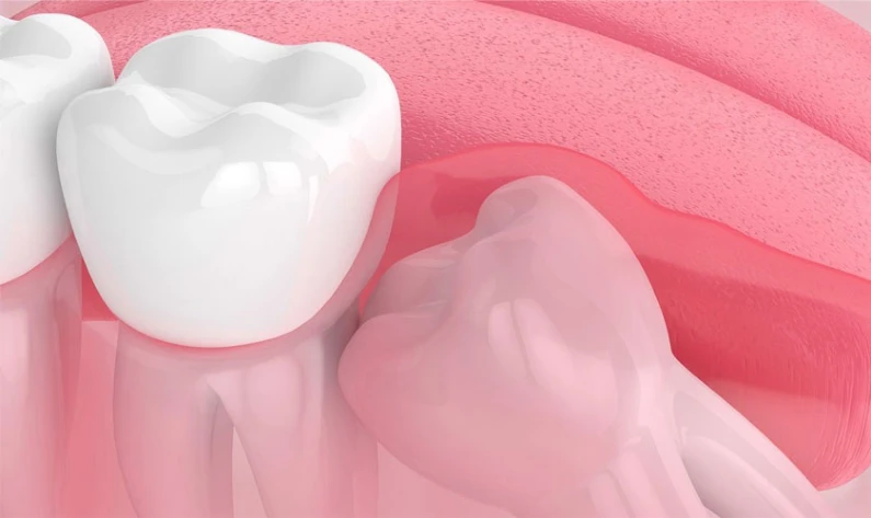 Thế Giới Implant