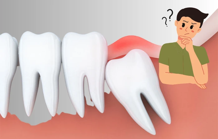 Thế Giới Implant