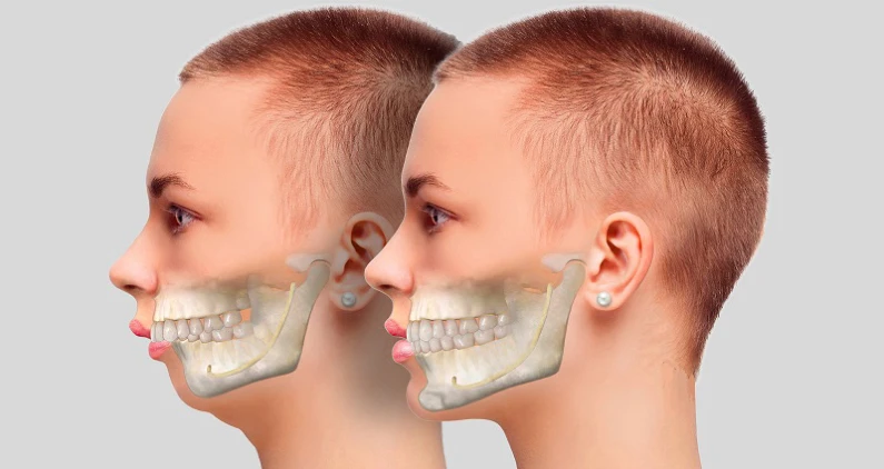 Thế Giới Implant