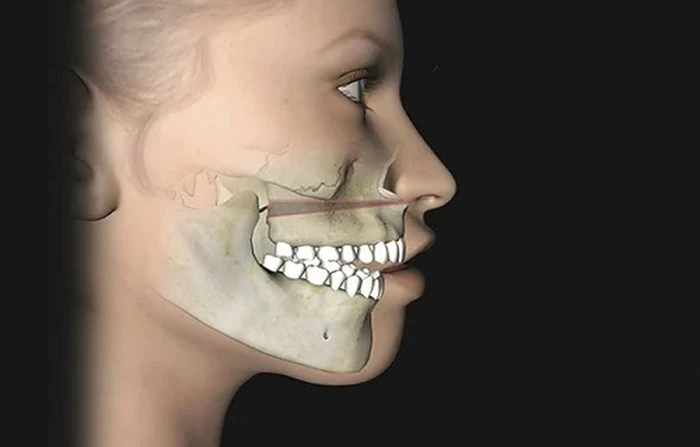 Thế Giới Implant