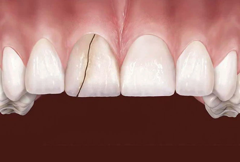 Thế Giới Implant