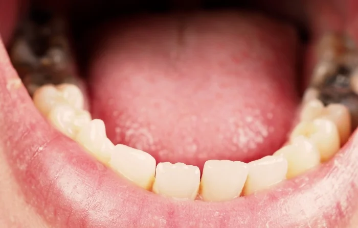 Thế Giới Implant