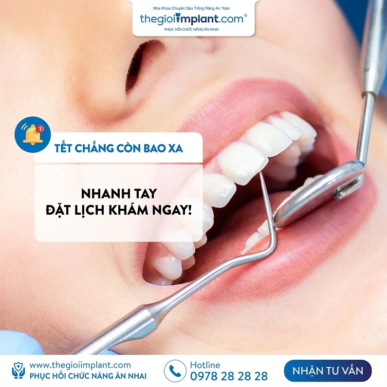 Thế Giới Implant