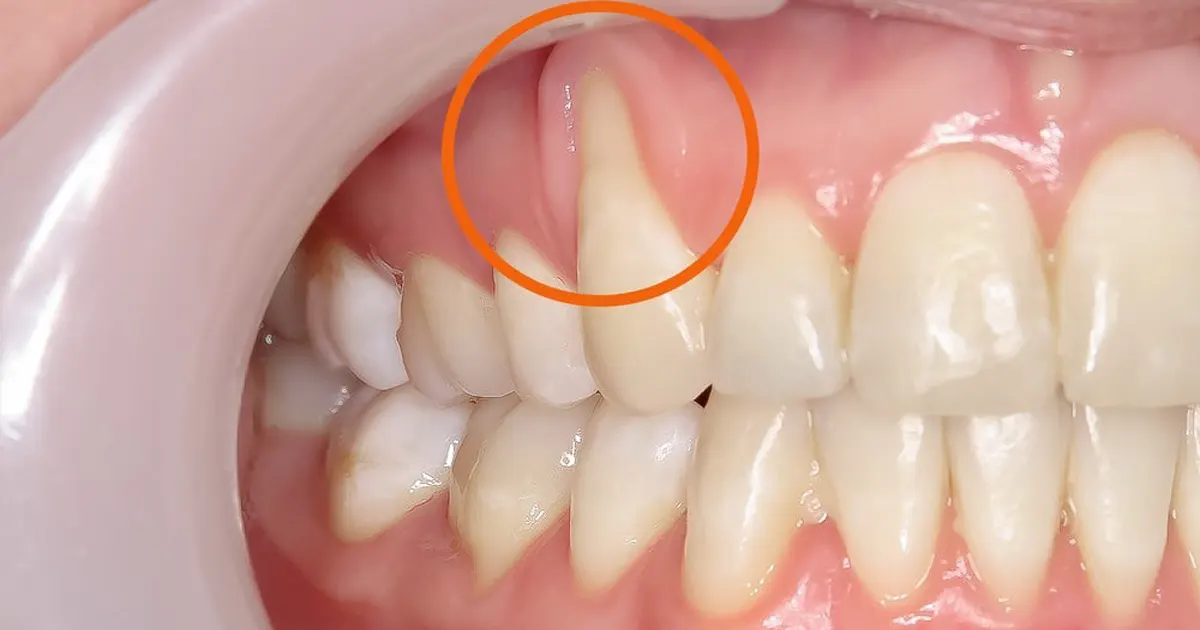 Thế Giới Implant