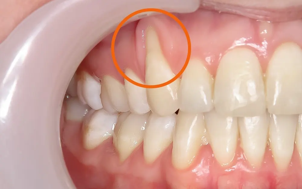 Thế Giới Implant