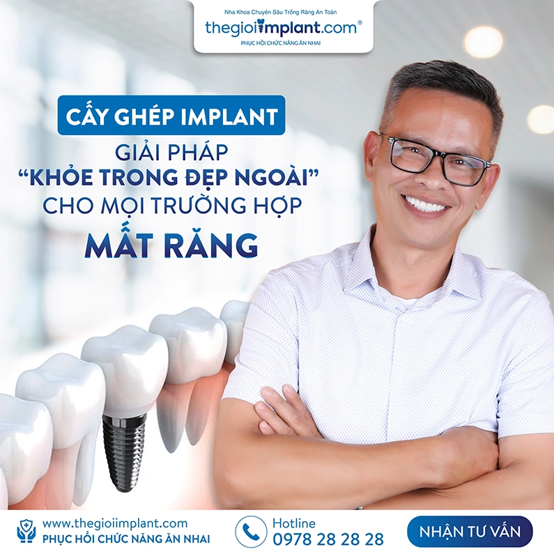 Thế Giới Implant