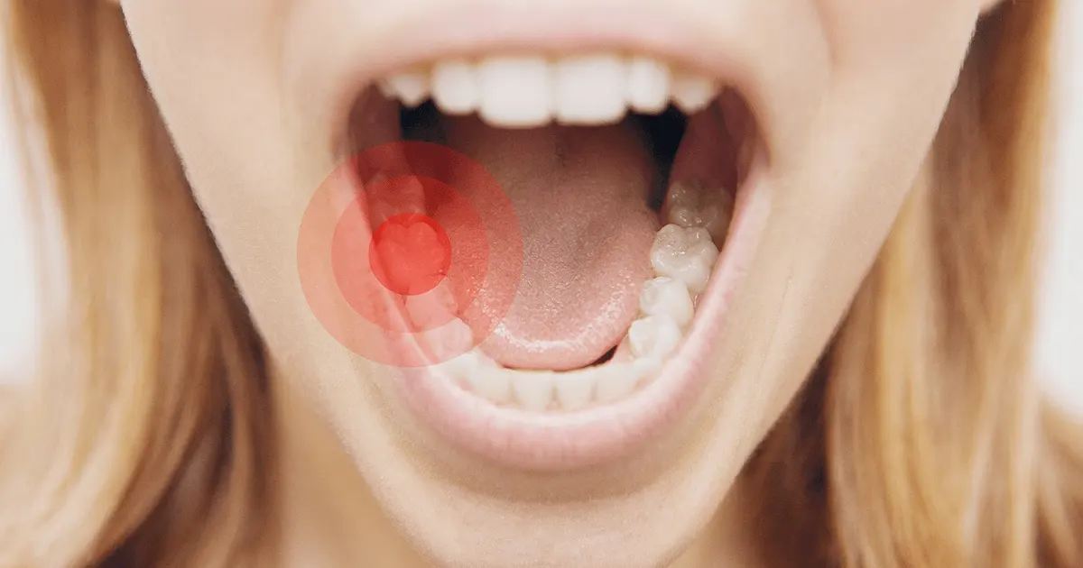 Thế Giới Implant