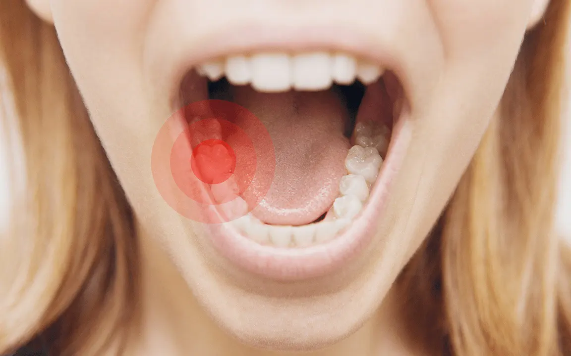 Thế Giới Implant