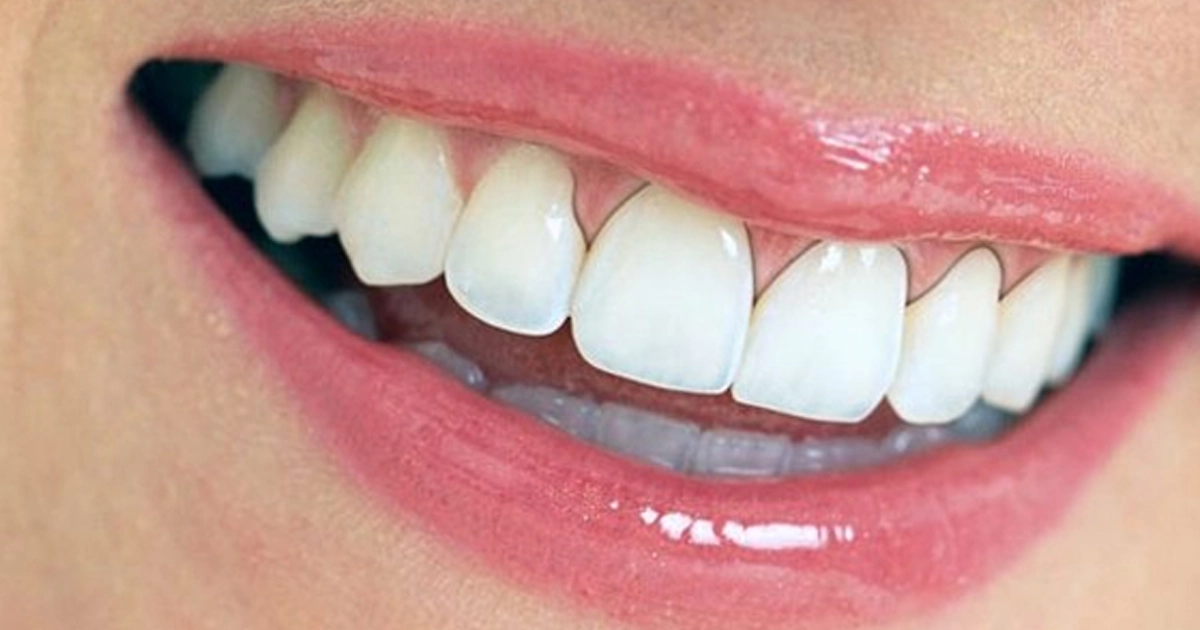 Thế Giới Implant