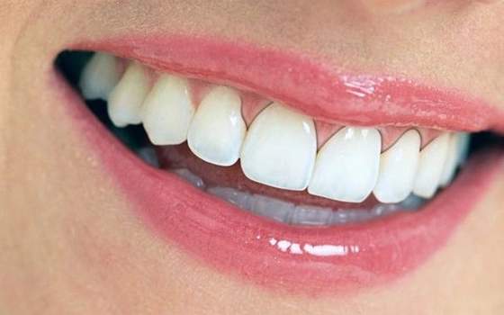 Thế Giới Implant