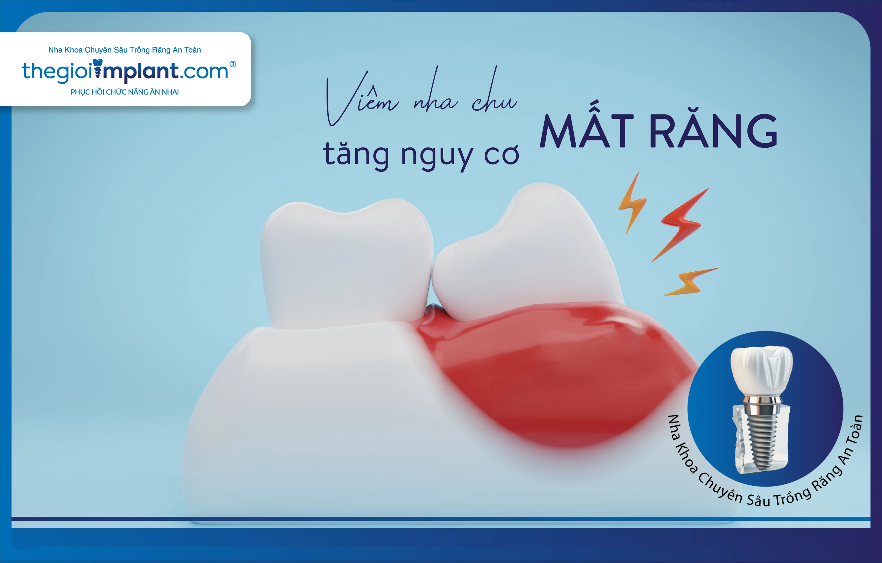 Thế Giới Implant