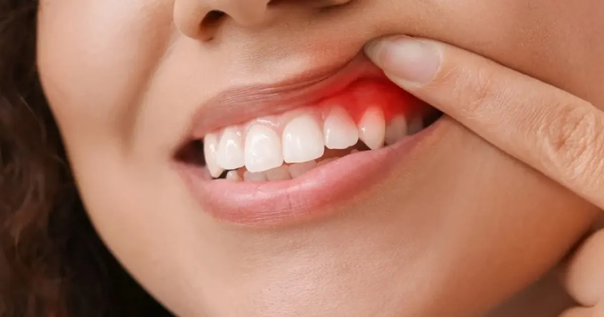 Thế Giới Implant