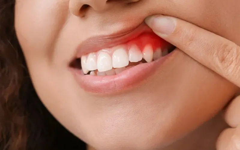 Thế Giới Implant