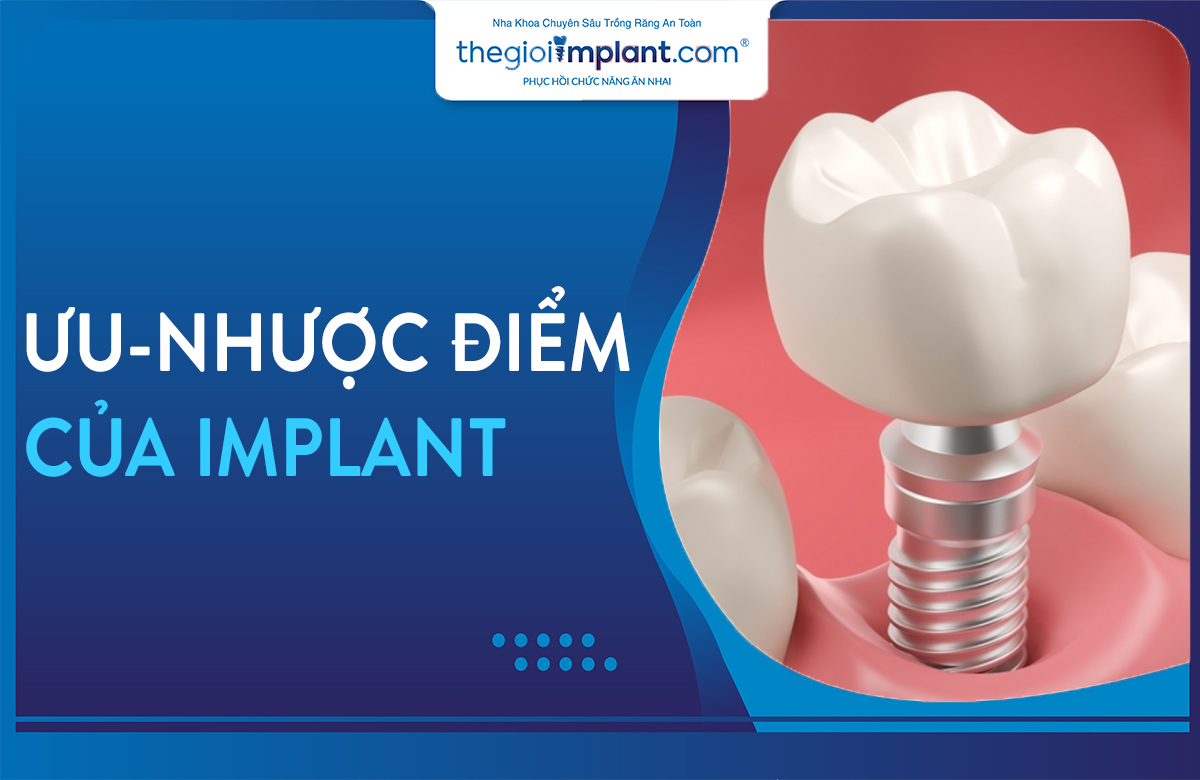 nhược điểm của trồng răng implant