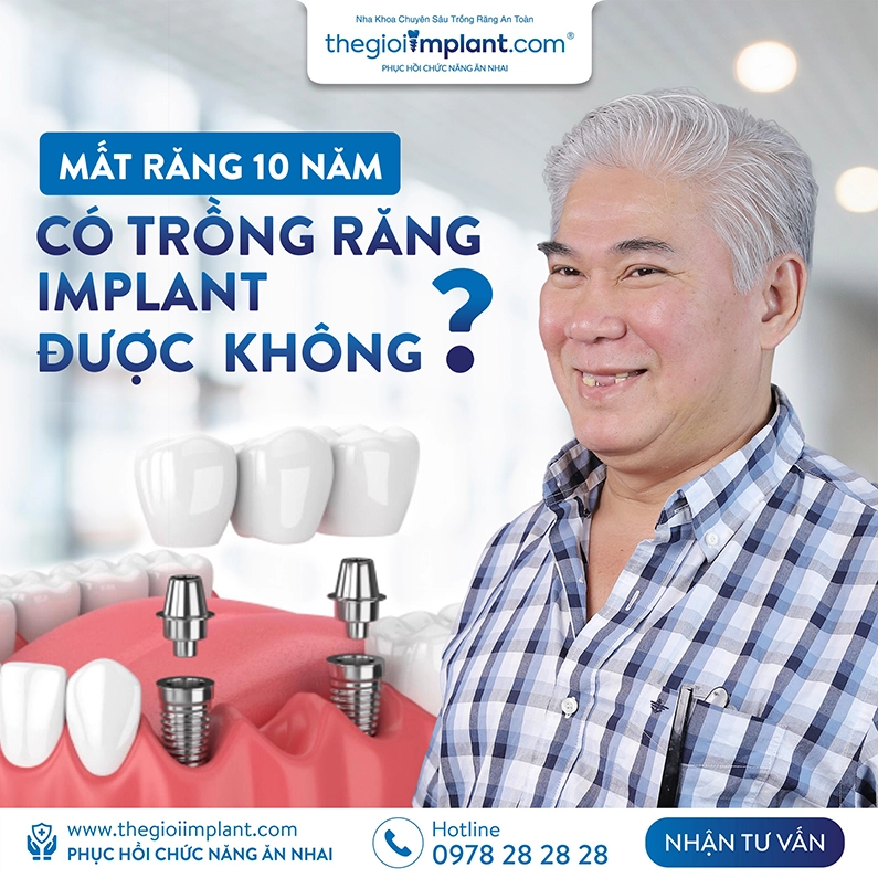 Thế Giới Implant