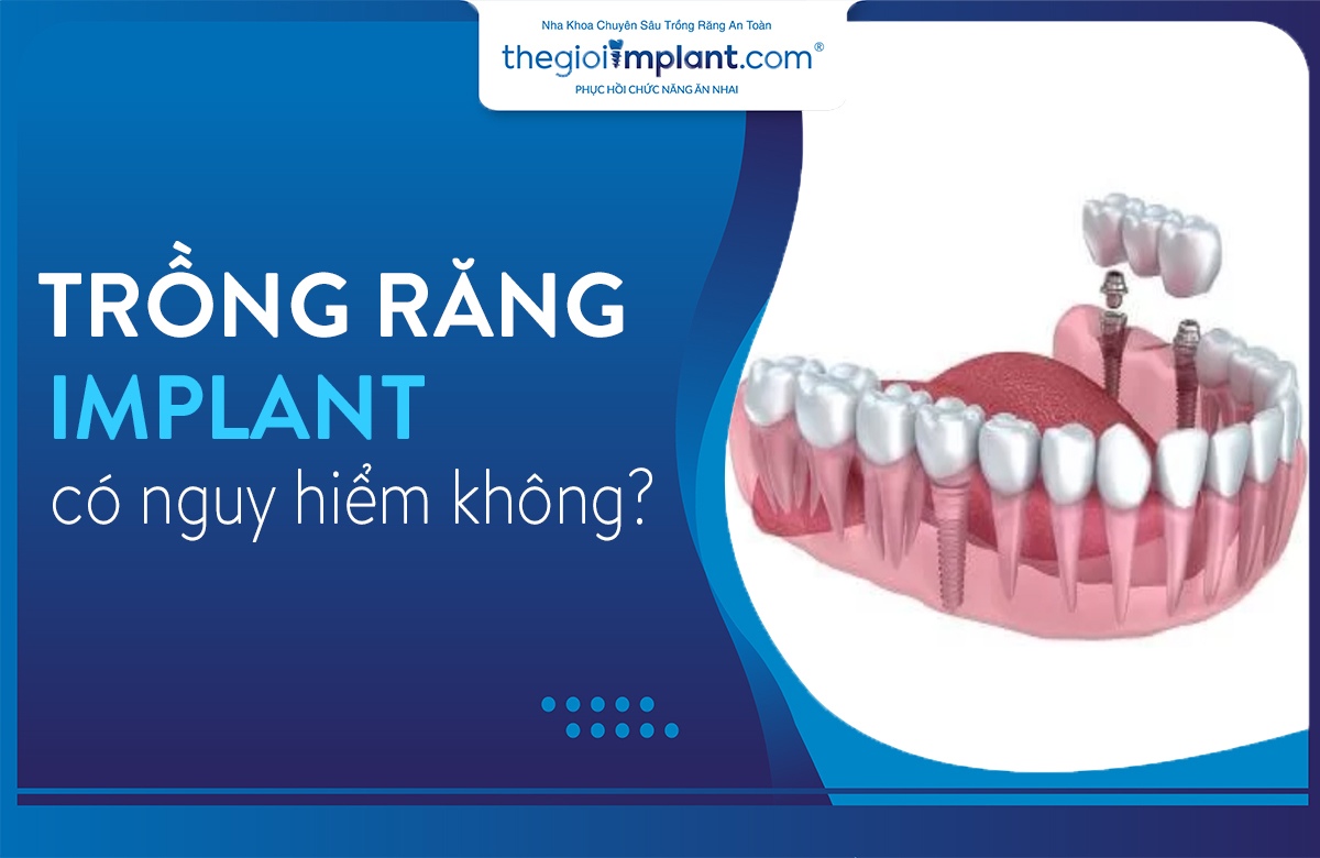 trồng răng implant có nguy hiểm không