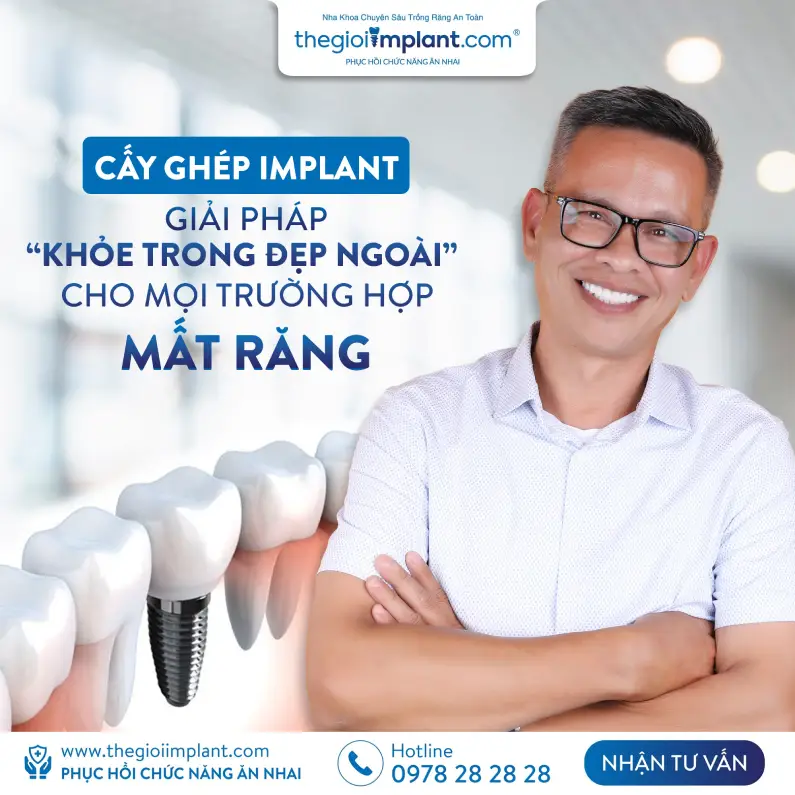 Thế Giới Implant