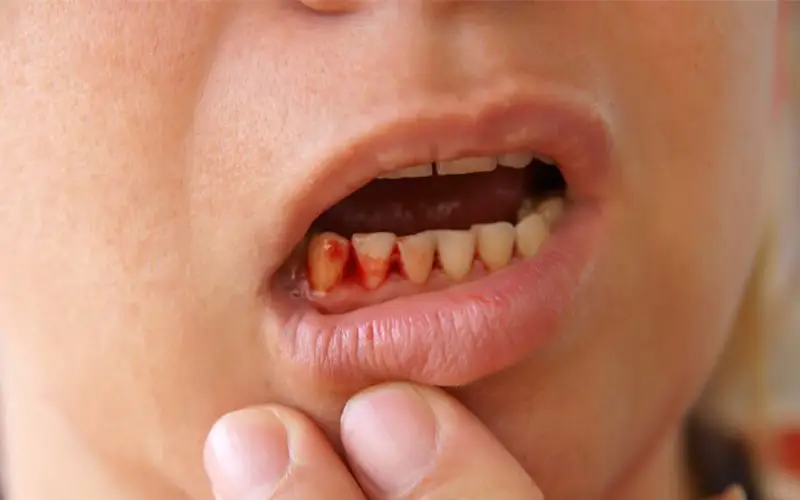 Thế Giới Implant