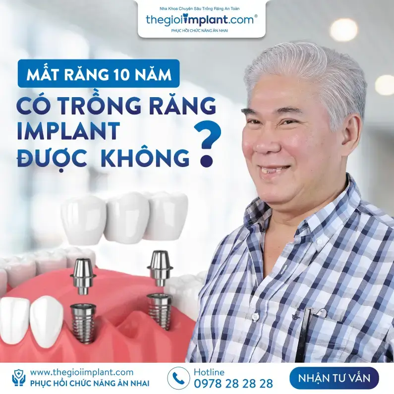 Thế Giới Implant