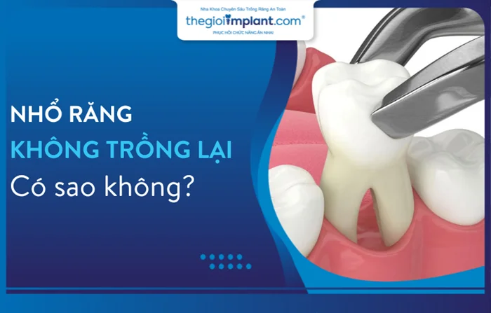 Nhổ răng không trồng răng lại có sao không?