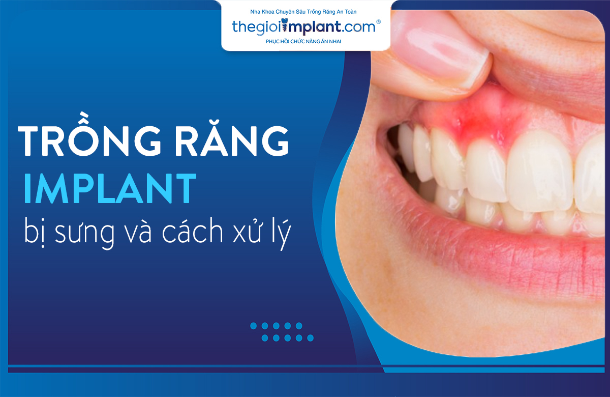Thumnail trồng răng implant bị sưng
