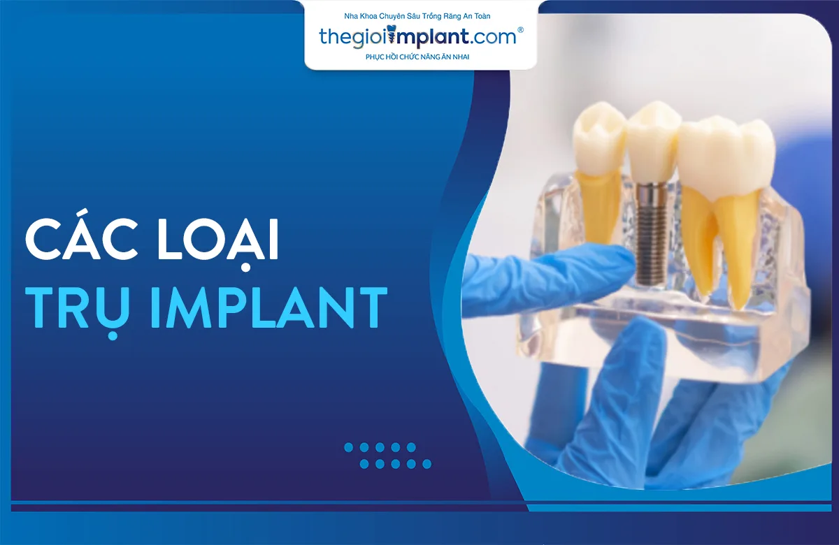 Thumnail trụ implant