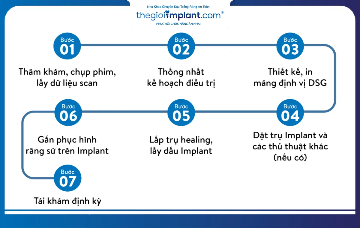 Quy trình trồng implant răng cửa an toàn tại thegioiimplant.com