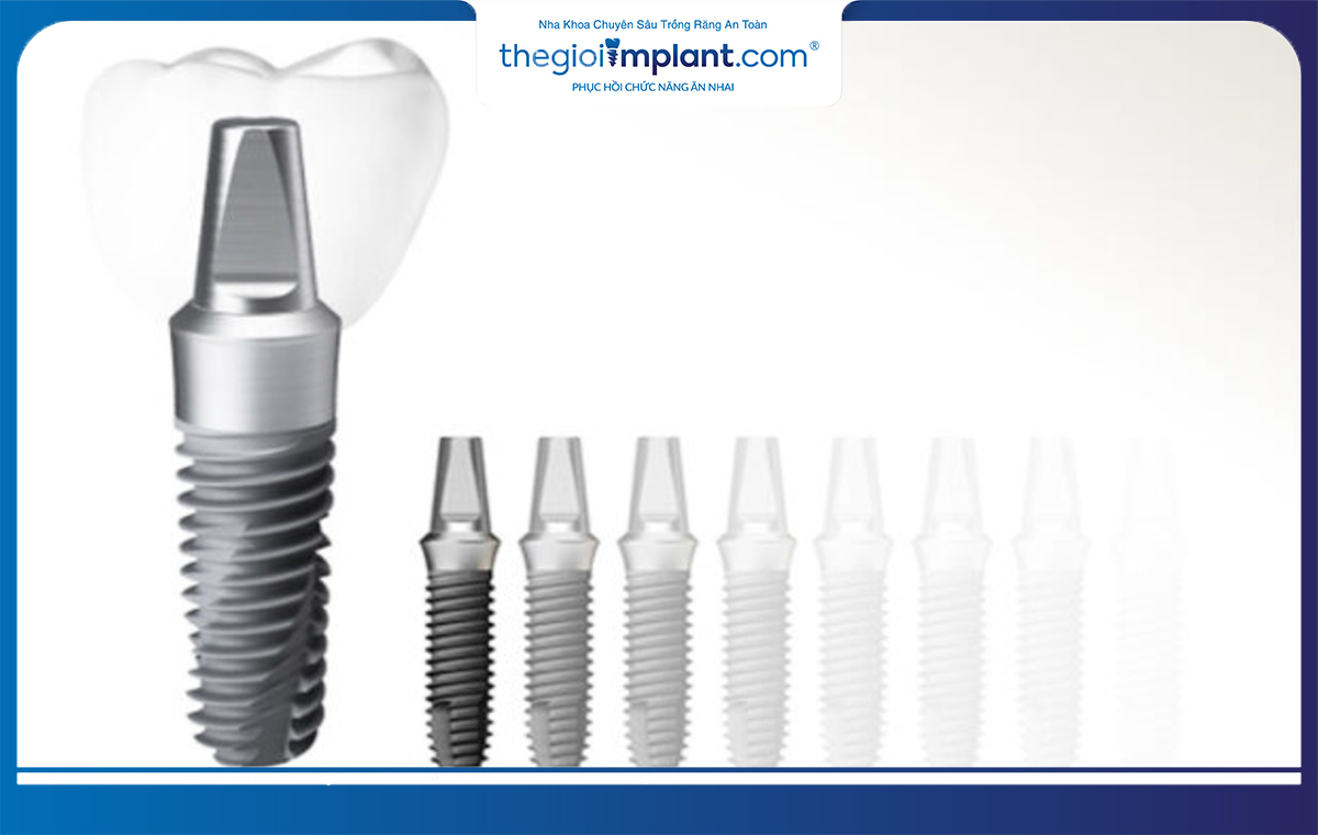 Implant Mỹ dù có giá thành cao nhưng độ bền và tuổi thọ được đảm bảo