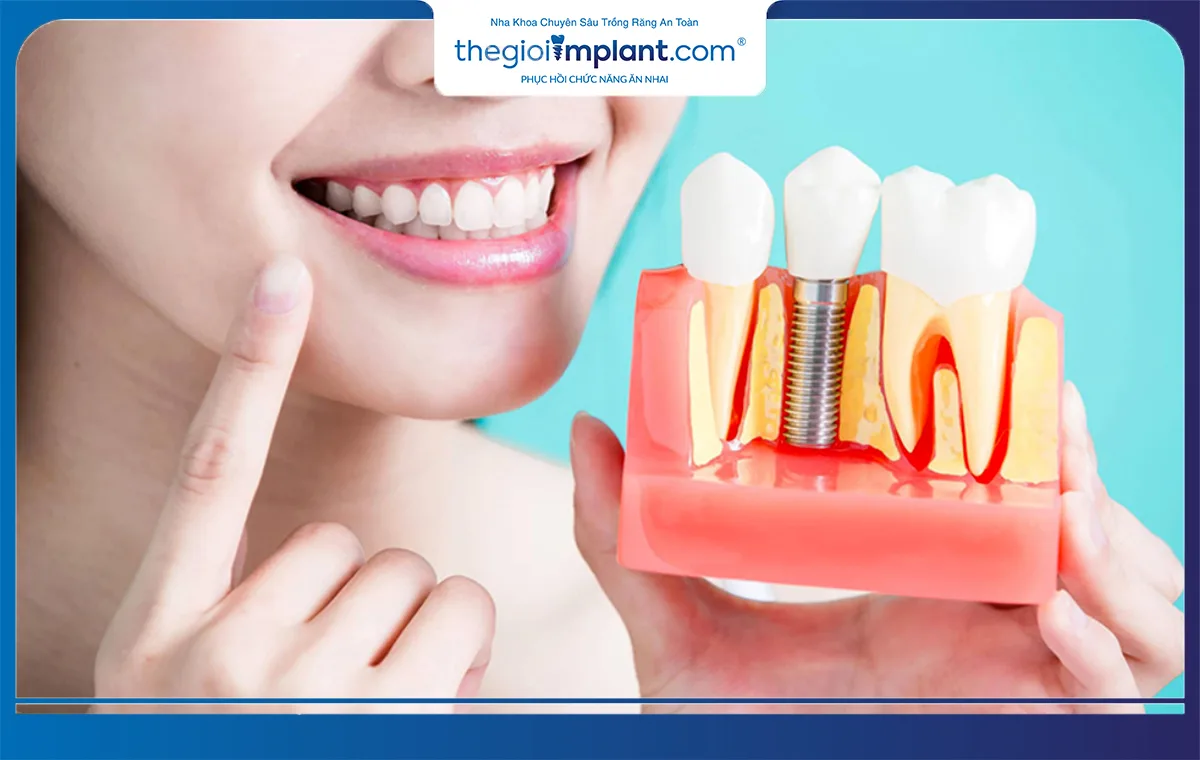 Trụ implant Hàn Quốc chủ yếu được làm từ titanium nguyên chất