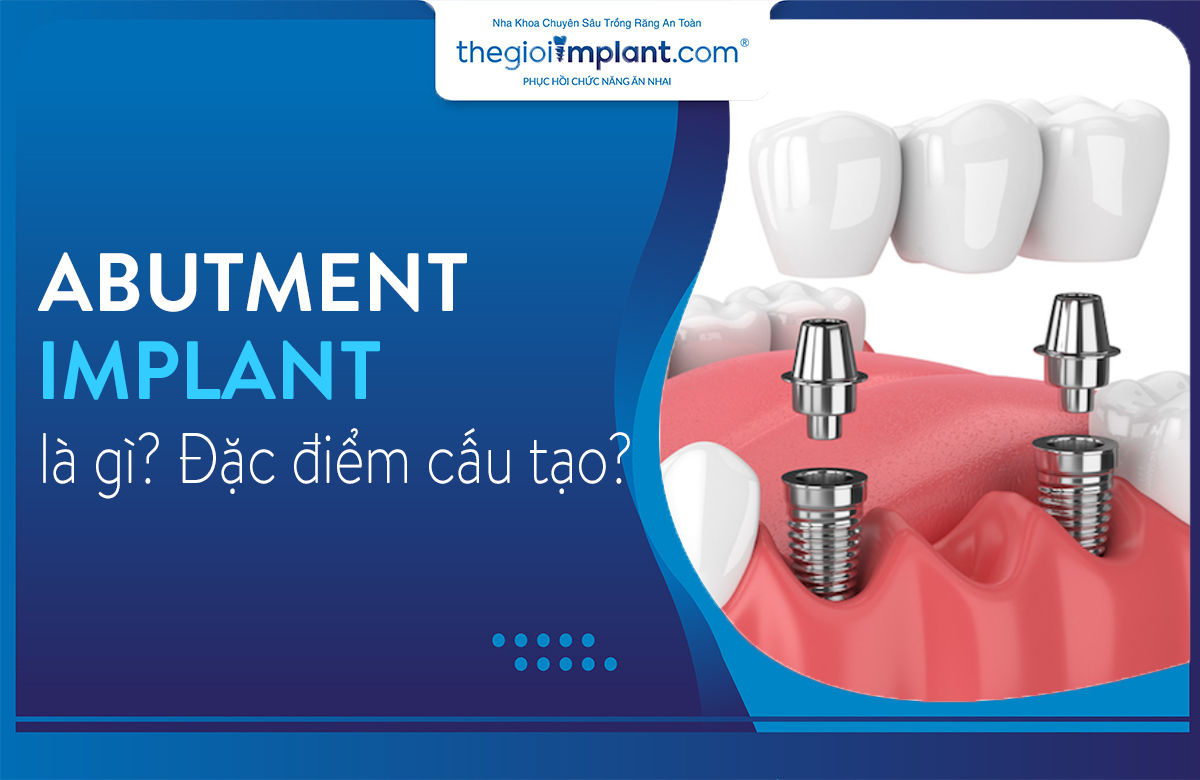 abutment implant thumbnail