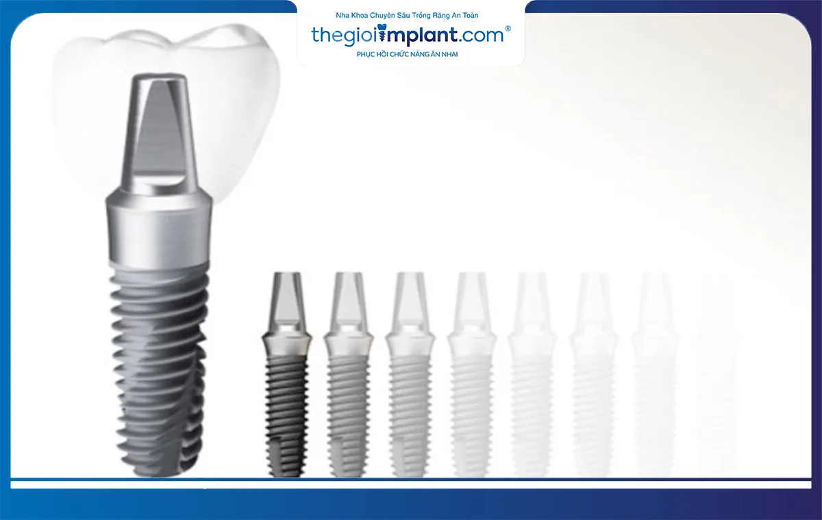 Implant Dentium Mỹ là dòng sản phẩm dẫn đầu phân khúc trụ implant cận cao cấp