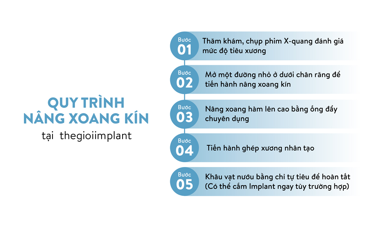 Quy trình nâng xoang kín tại nha khoa thegioiimplant