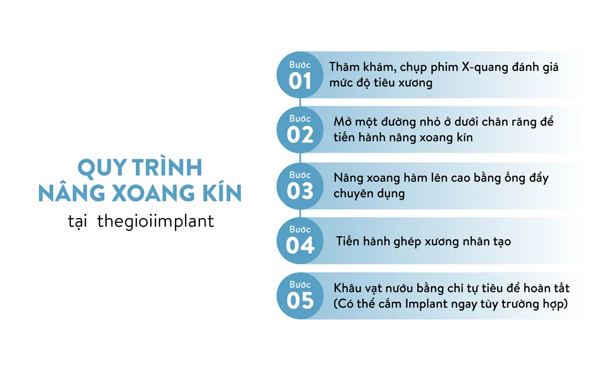 Quy trình nâng xoang kín tại nha khoa thegioiimplant
