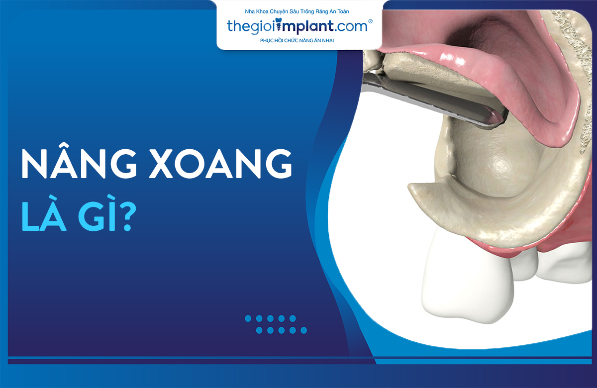 nâng xoang kín thumbnail