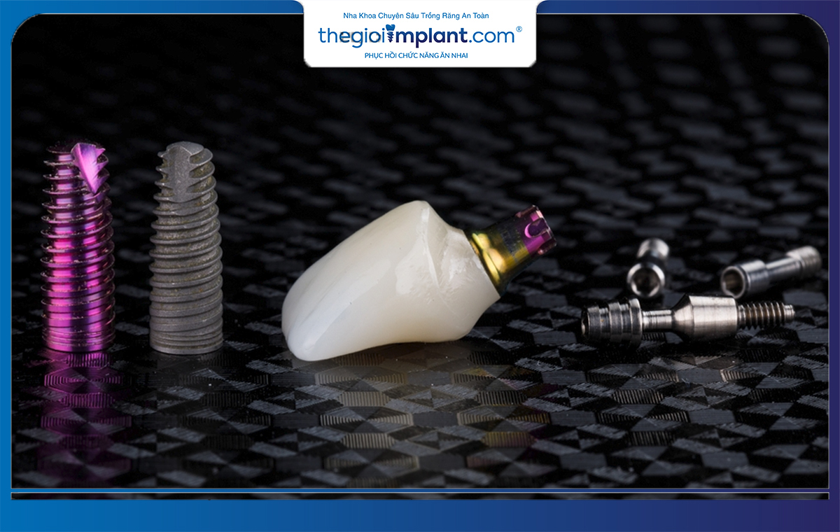 Trồng răng implant mang lại nhiều ưu điểm hơn so với phương pháp cầu răng sứ